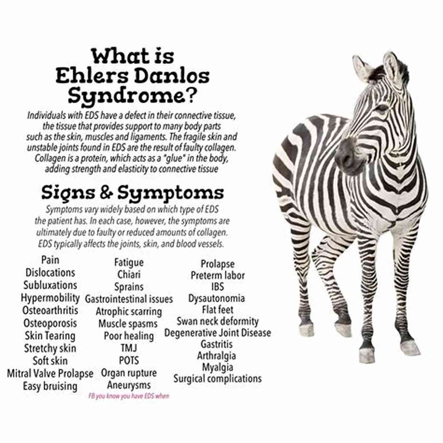 Support For Ehlers Danlos Syndrome Being Built Wrong: One Woman S Struggle With Ehlers Danlos Syndrome
